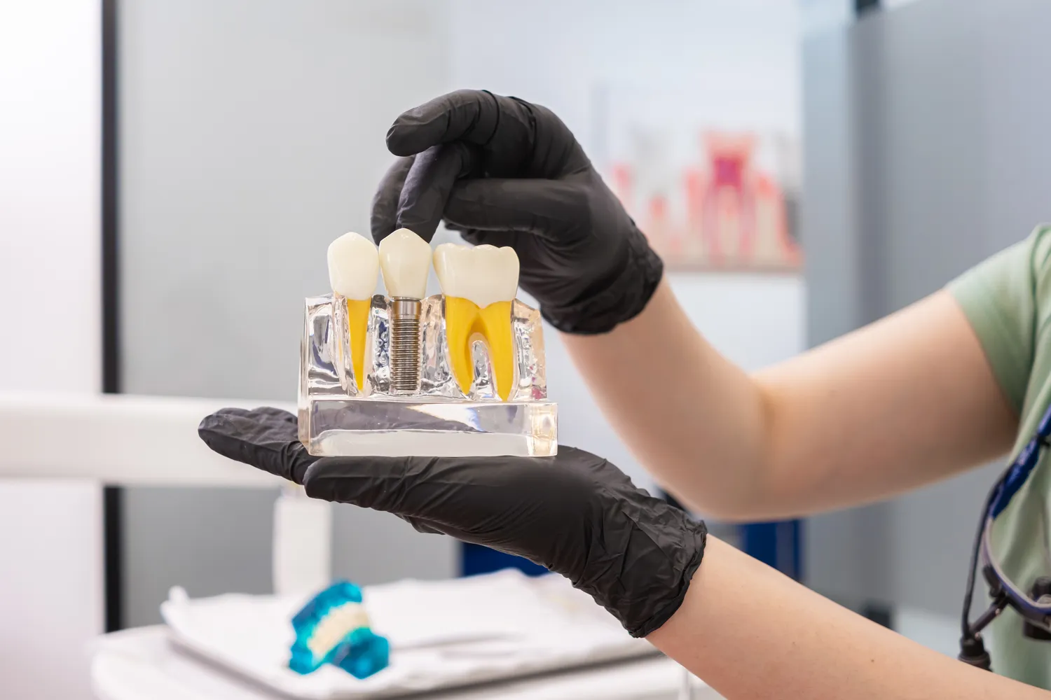 Endodoncja stomatologiczna Szczecin