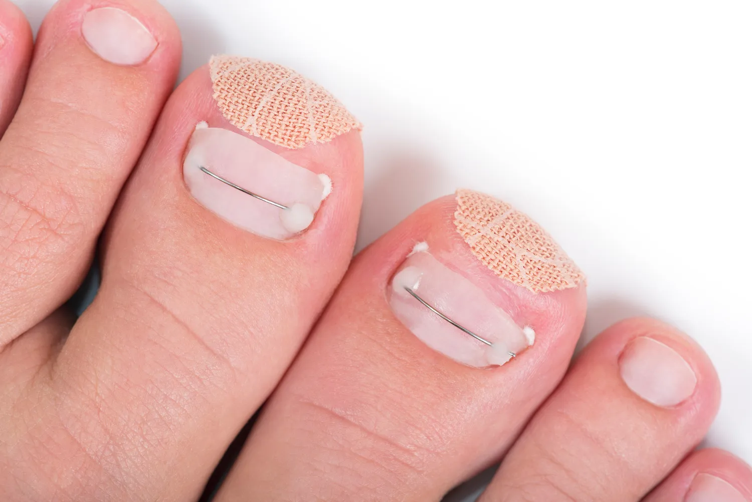 Co warto wiedzieć o leczniczym pedicure?