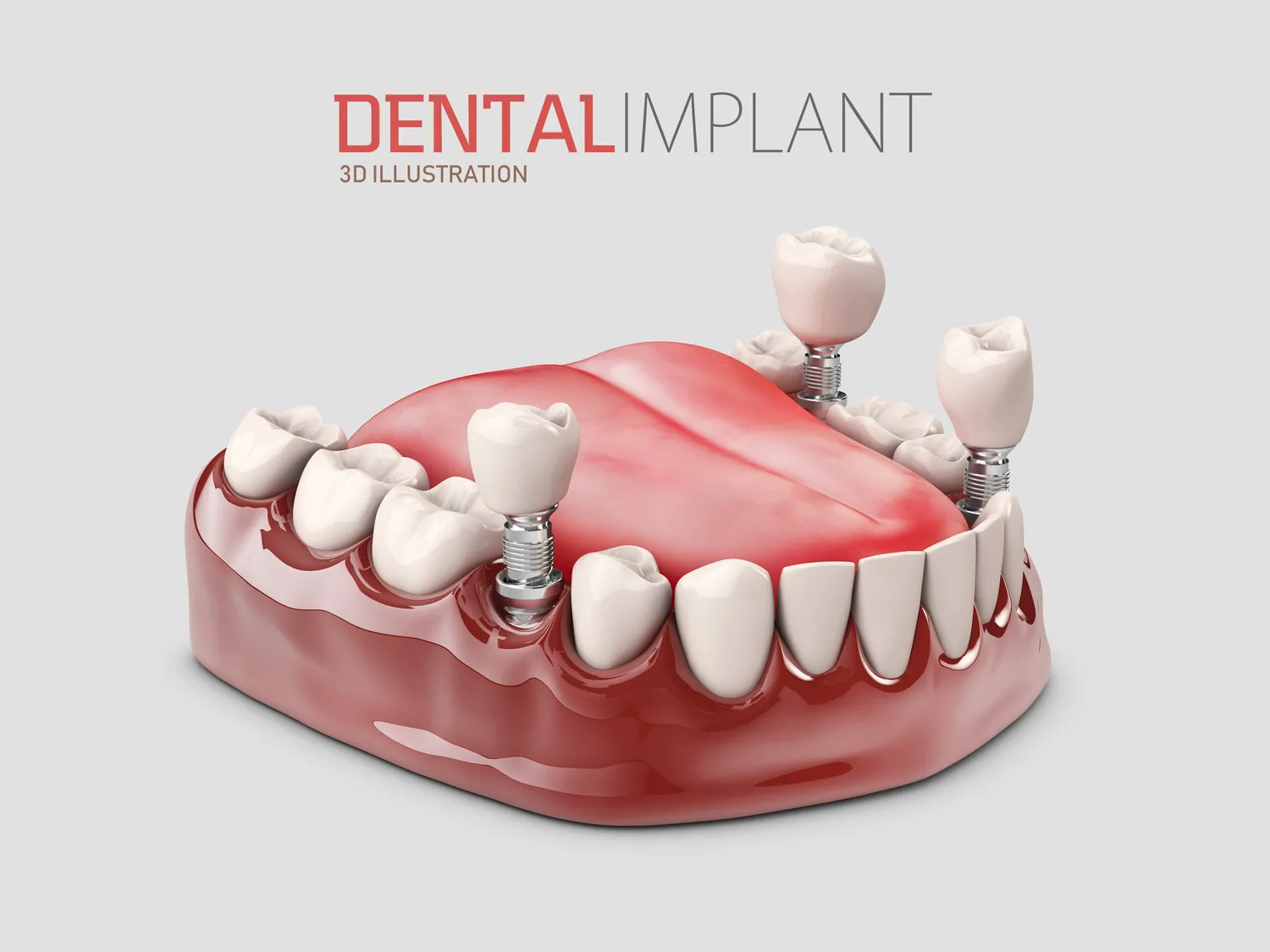 Endodoncja mikroskopowa Szczecin