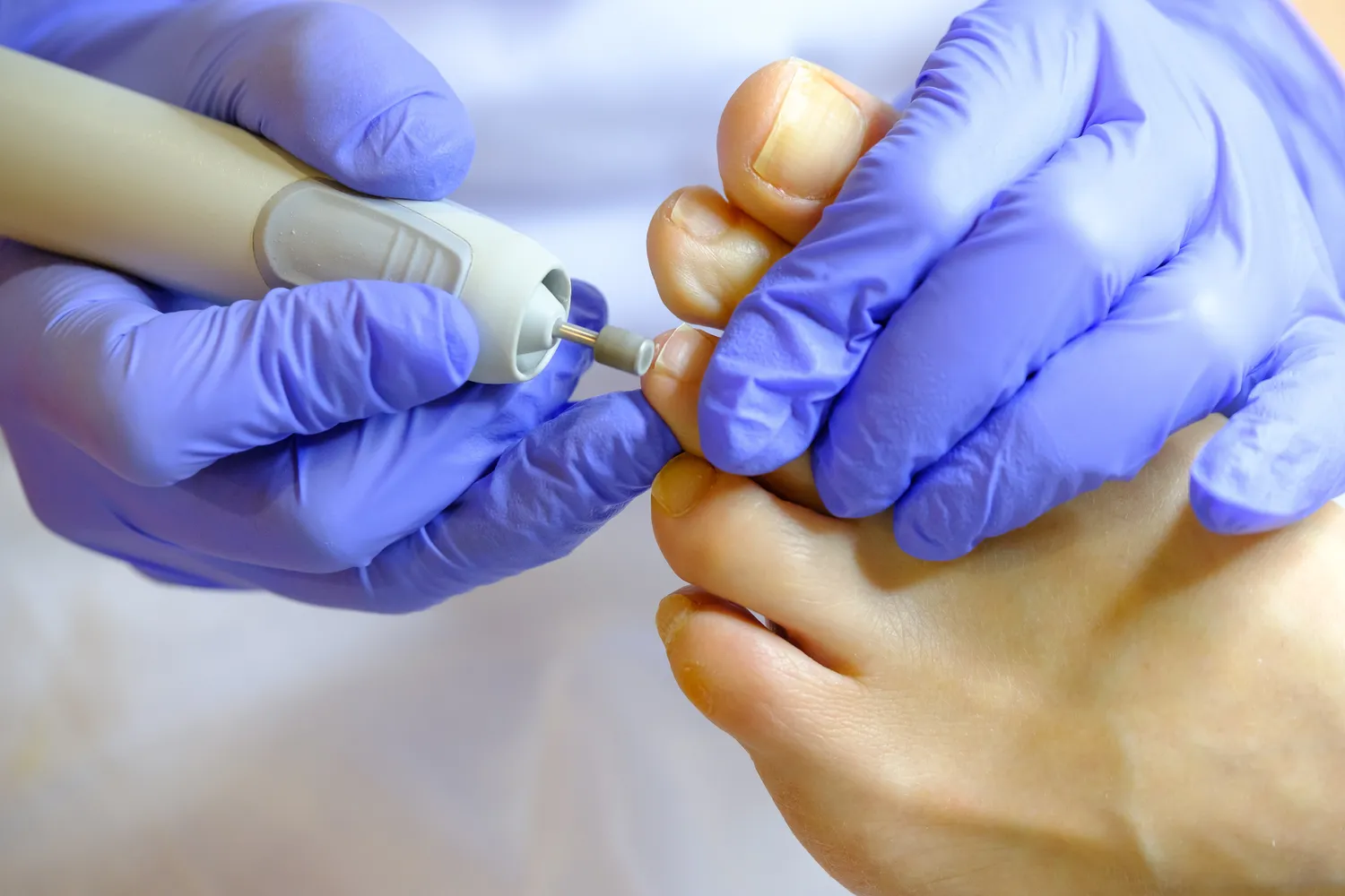 Pedicure podologiczne Warszawa