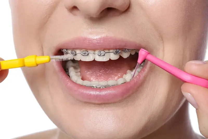 Najlepszy stomatolog Warszawa