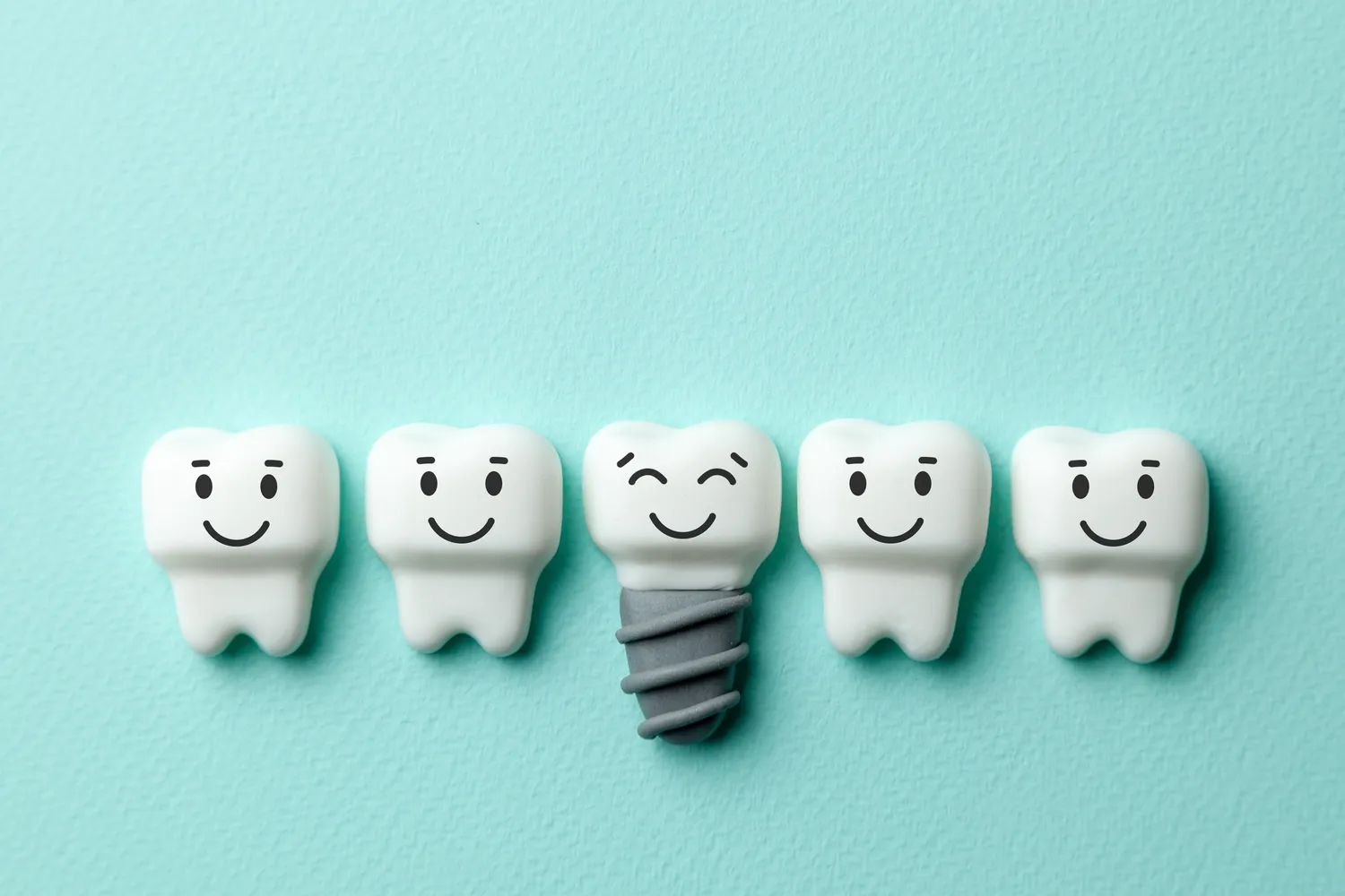 Implanty dentystyczne - czy mogą zastąpić prawdziwe zęby?